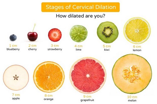 Cervical dilation
