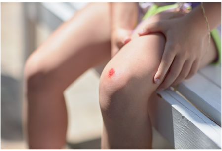 wounded knee