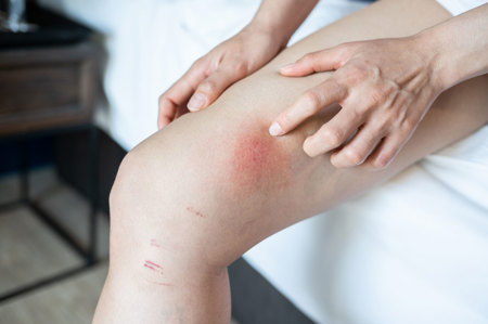 Card image of Chafing uses 