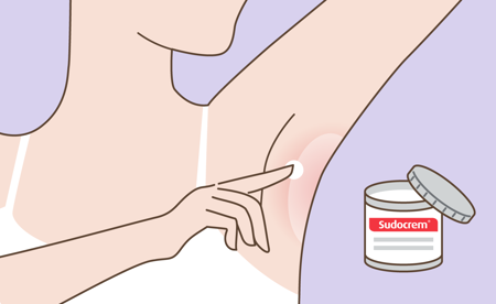 Card image for application of Sudocrem on the armpit