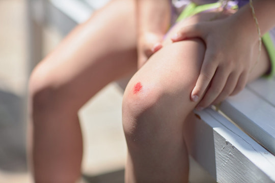 Image for Cuts and grazes Sudocrem