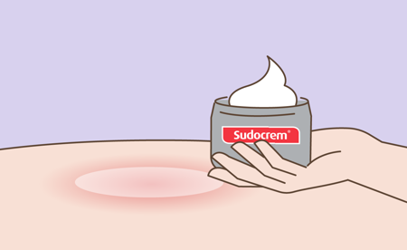 Animated version of a hand holding Sudocrem near skin